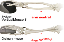 Evoluent Verticalmouse Arm Ergonomics