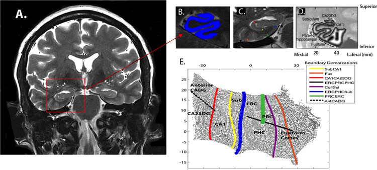 How Sitting Affects Your Brain